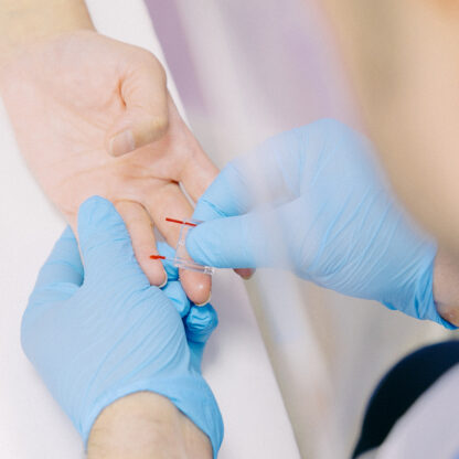 Image of blood sample being taken via finger prick test