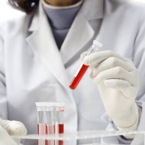  Why are Blood Tests Important for your Health?