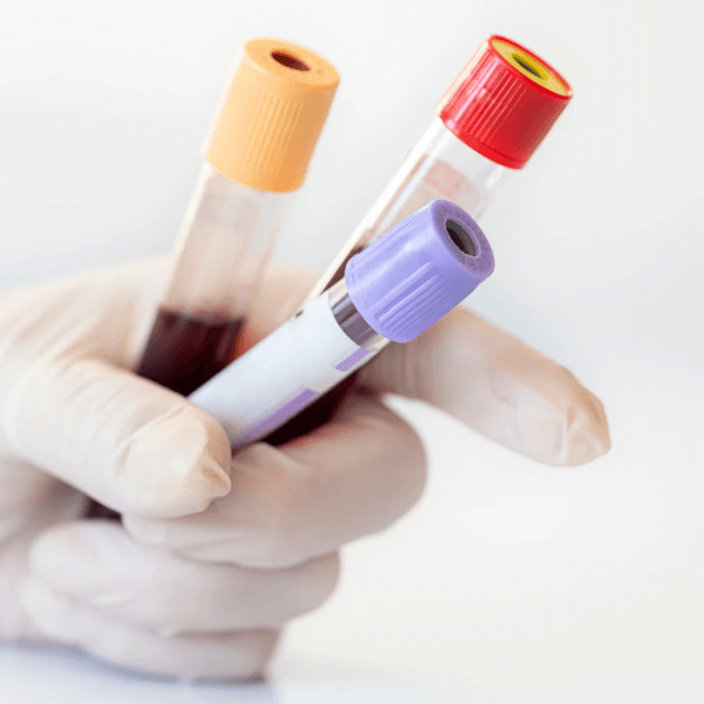 hand choosing blood tests