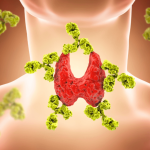  Exploring the Role of Thyroid Antibodies in Thyroid Health