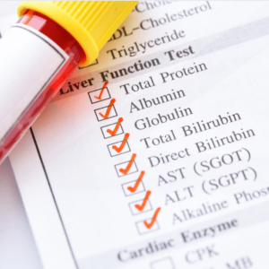  LFT Blood Test: Understanding Liver Health